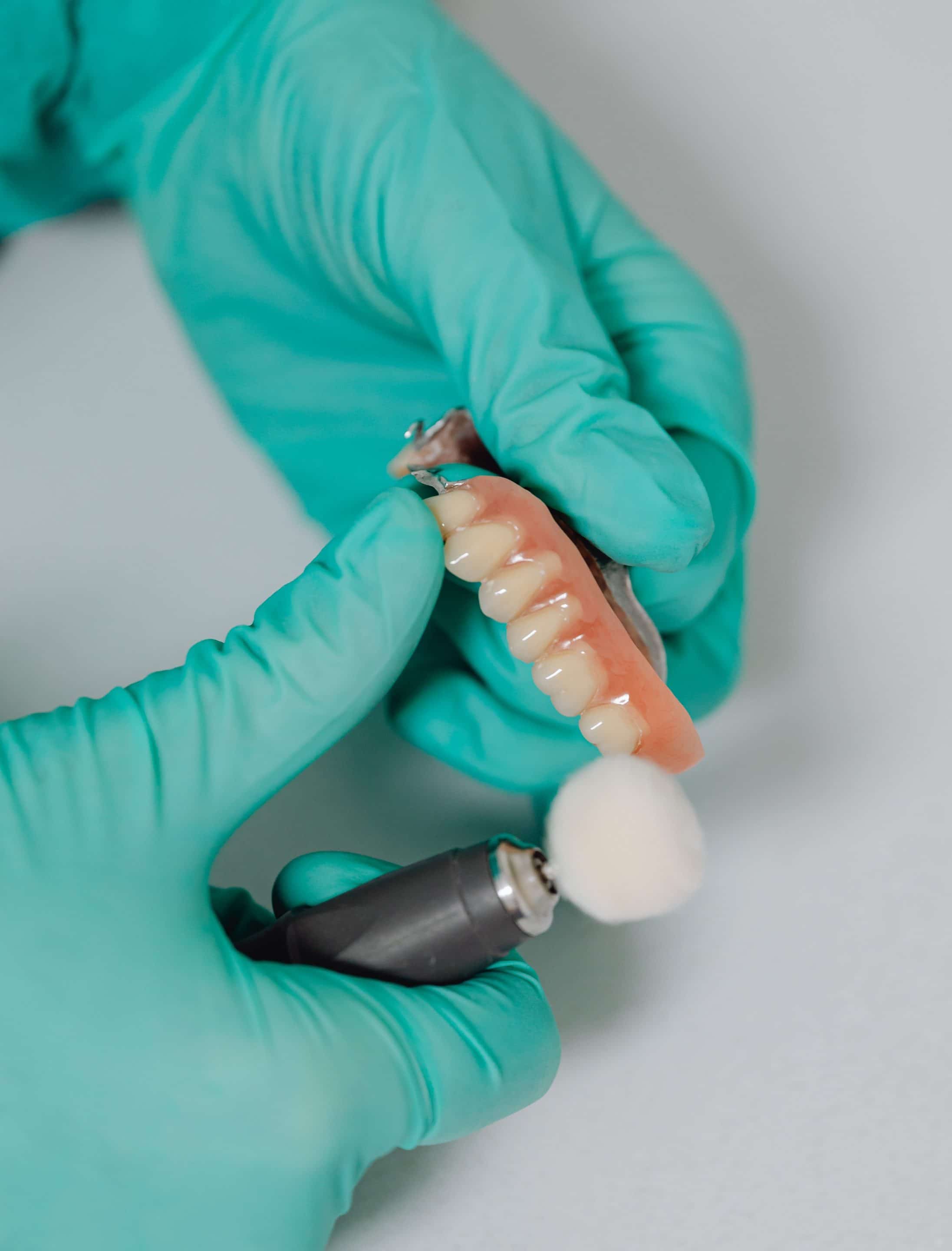 rehabilitacion-oral-mediante-protesis-dentales-en-oviedo